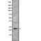 RAB35, Member RAS Oncogene Family antibody, abx218123, Abbexa, Western Blot image 