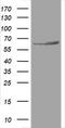 Heat Shock Protein Family D (Hsp60) Member 1 antibody, TA800758BM, Origene, Western Blot image 