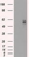Fyn Related Src Family Tyrosine Kinase antibody, LS-C114623, Lifespan Biosciences, Western Blot image 