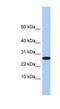 Refilin A antibody, NBP1-79528, Novus Biologicals, Western Blot image 