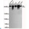 Chromodomain Helicase DNA Binding Protein 3 antibody, LS-C812915, Lifespan Biosciences, Western Blot image 