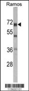 DEAD-Box Helicase 5 antibody, 62-931, ProSci, Western Blot image 