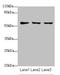 Thymic stromal cotransporter protein antibody, orb37182, Biorbyt, Western Blot image 