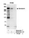 Senataxin antibody, NB100-57543, Novus Biologicals, Western Blot image 