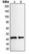 Neuropeptide Y Receptor Y2 antibody, LS-C352597, Lifespan Biosciences, Western Blot image 