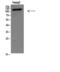 hTERT antibody, GTX03646, GeneTex, Western Blot image 