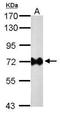 Helicobacter pylori urease B antibody, NBP2-42853, Novus Biologicals, Western Blot image 