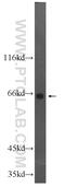 DEAD-Box Helicase 56 antibody, 21989-1-AP, Proteintech Group, Western Blot image 