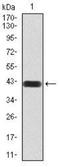 Matrix Metallopeptidase 14 antibody, NBP2-52512, Novus Biologicals, Western Blot image 