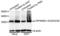 Ribosomal Protein S6 antibody, STJ113489, St John