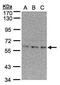 EPM2A-interacting protein 1 antibody, PA5-21885, Invitrogen Antibodies, Western Blot image 