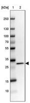 RCC1 And BTB Domain Containing Protein 2 antibody, PA5-59118, Invitrogen Antibodies, Western Blot image 