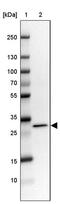 RCC1 And BTB Domain Containing Protein 2 antibody, PA5-59118, Invitrogen Antibodies, Western Blot image 