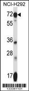 Solute Carrier Family 41 Member 2 antibody, 57-301, ProSci, Western Blot image 