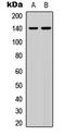 SRC Kinase Signaling Inhibitor 1 antibody, LS-C358333, Lifespan Biosciences, Western Blot image 