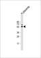 Pregnancy Specific Beta-1-Glycoprotein 6 antibody, 60-266, ProSci, Western Blot image 