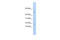 V-Set Pre-B Cell Surrogate Light Chain 1 antibody, 25-759, ProSci, Enzyme Linked Immunosorbent Assay image 