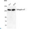 Integrin Subunit Alpha 5 antibody, LS-C813016, Lifespan Biosciences, Western Blot image 