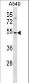 Transmembrane 6 Superfamily Member 1 antibody, LS-C161942, Lifespan Biosciences, Western Blot image 