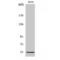 Serpin Family G Member 1 antibody, LS-C382363, Lifespan Biosciences, Western Blot image 