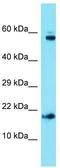Adaptor Related Protein Complex 1 Subunit Sigma 1 antibody, TA331243, Origene, Western Blot image 