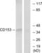 TNF Superfamily Member 8 antibody, abx013468, Abbexa, Western Blot image 