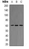AKT Serine/Threonine Kinase 2 antibody, LS-C413169, Lifespan Biosciences, Western Blot image 