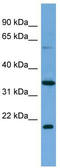 MIER Family Member 2 antibody, TA344991, Origene, Western Blot image 
