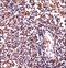 Hematopoietic Cell-Specific Lyn Substrate 1 antibody, LS-C166815, Lifespan Biosciences, Immunohistochemistry paraffin image 