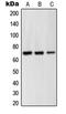 G Protein-Coupled Receptor Kinase 6 antibody, LS-C352269, Lifespan Biosciences, Western Blot image 