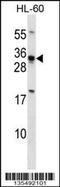 Homeobox B8 antibody, 58-305, ProSci, Western Blot image 