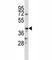CD86 antibody, F44504-0.4ML, NSJ Bioreagents, Western Blot image 