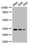 Murein tetrapeptide carboxypeptidase antibody, A53134-100, Epigentek, Western Blot image 