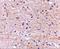 SATB Homeobox 2 antibody, A02588, Boster Biological Technology, Immunohistochemistry paraffin image 