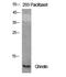 Ghrelin And Obestatin Prepropeptide antibody, A01710-1, Boster Biological Technology, Western Blot image 