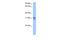 TRNA Methyltransferase 10B antibody, A16935, Boster Biological Technology, Western Blot image 