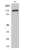 Cbl Proto-Oncogene antibody, STJ92056, St John