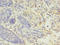 Lysozyme antibody, A50616-100, Epigentek, Immunohistochemistry paraffin image 
