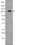 EPH Receptor B1 antibody, PA5-64789, Invitrogen Antibodies, Western Blot image 