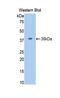 Insulin Receptor antibody, LS-C304775, Lifespan Biosciences, Western Blot image 