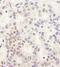 DEAH-Box Helicase 38 antibody, NB110-40583, Novus Biologicals, Immunohistochemistry paraffin image 