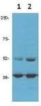 Cyclin Dependent Kinase 9 antibody, A00794, Boster Biological Technology, Western Blot image 