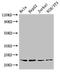 Ribosomal Protein S5 antibody, LS-C679358, Lifespan Biosciences, Western Blot image 