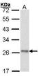ATP Synthase Peripheral Stalk Subunit OSCP antibody, GTX101942, GeneTex, Western Blot image 
