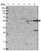 Transmembrane Protein 39B antibody, NBP1-83868, Novus Biologicals, Western Blot image 