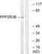 Protein Phosphatase 2 Regulatory Subunit B''Beta antibody, LS-C120378, Lifespan Biosciences, Western Blot image 