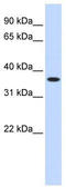 Zinc Finger Protein 444 antibody, TA339508, Origene, Western Blot image 