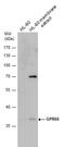 G Protein-Coupled Receptor 55 antibody, GTX108243, GeneTex, Western Blot image 