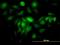 Ferritin Light Chain antibody, H00002512-M16, Novus Biologicals, Immunofluorescence image 