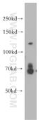Ubiquitin Specific Peptidase 37 antibody, 18465-1-AP, Proteintech Group, Western Blot image 